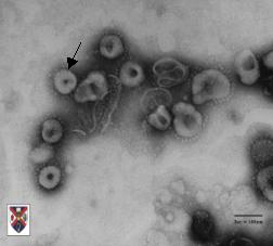wabah penyakit virus corona gambar mikroskop-dakwah.id